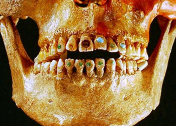 Descubre los Secretos de la Cirugía Maya